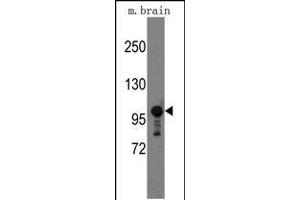 Western blot analysis of mouse anti-Semaphorin 5A Pab (ABIN389166 and ABIN2839332) in mouse brain tissue lysates (35 μg/lane). (SEMA5A anticorps  (AA 1006-1035))