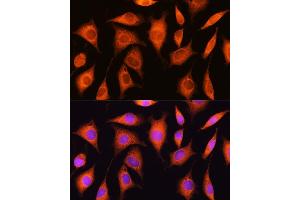 Immunofluorescence analysis of L929 cells using EXOSC2 Rabbit pAb (ABIN6127886, ABIN6140374, ABIN6140375 and ABIN6214708) at dilution of 1:100.