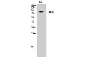 Western Blotting (WB) image for anti-T-Box 3 (TBX3) (Internal Region) antibody (ABIN3177644) (TBX3 anticorps  (Internal Region))