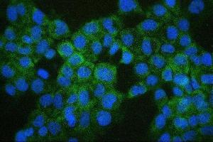IF analysis of COMT using anti-COMT antibody (ABIN7601948).