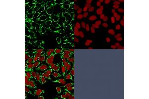 Immunofluorescence Analysis of MeOH-fixed HeLa cells labeled with HIF1 alpha Mouse Monoclonal Antibody (HIF1A/84) followed bygoat anti-mouse IgG-CF488 (Green).