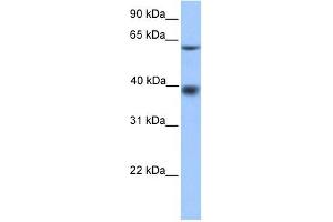 MFSD4 antibody used at 1 ug/ml to detect target protein. (MFSD4 anticorps  (N-Term))