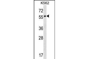 RARB Antibody (Center) (ABIN1537931 and ABIN2849656) western blot analysis in K562 cell line lysates (35 μg/lane). (Retinoic Acid Receptor beta anticorps  (AA 168-195))