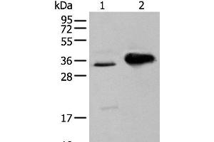 Western blot analysis of TM4 cell and Mouse brain tissue using ATP6V1E2 Polyclonal Antibody at dilution of 1:400