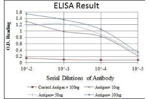 anti-Oligodendrocyte Lineage Transcription Factor 2 (OLIG2) antibody