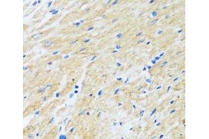 Immunohistochemistry of paraffin-embedded Rat heart using BAG3 Polyclonal Antibody at dilution of 1:100 (40x lens). (BAG3 anticorps)