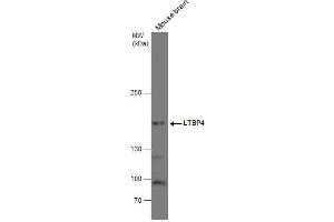 WB Image LTBP4 antibody detects LTBP4 protein by western blot analysis.
