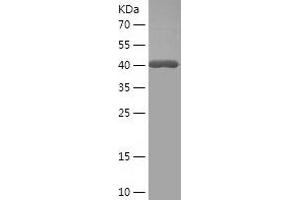 Western Blotting (WB) image for Prolactin Family 3, Subfamily B, Member 1 (PRL3B1) (AA 32-222) protein (His-IF2DI Tag) (ABIN7124586)