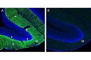 Expression of Secretin Receptor in mouse cerebellum - Immunohistochemical staining of perfusion-fixed frozen mouse brain sections with Anti-Secretin Receptor (extracellular) Antibody (ABIN7043607, ABIN7044414 and ABIN7044415), (1:200), followed by goat anti-rabbit-AlexaFluor-488. (SCTR anticorps  (Extracellular))