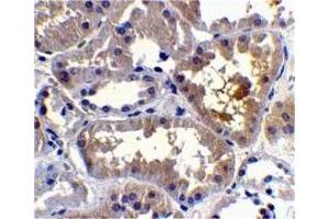 Immunohistochemistry (IHC) image for anti-CASP2 and RIPK1 Domain Containing Adaptor with Death Domain (CRADD) (C-Term) antibody (ABIN1030612) (CRADD anticorps  (C-Term))