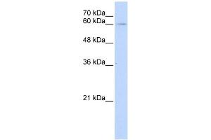 IL22R alpha 1 antibody used at 1 ug/ml to detect target protein.