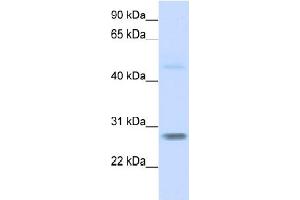 WB Suggested Anti-FBXO25  Antibody Titration: 0.
