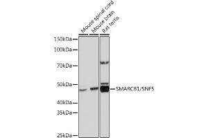 Western blot analysis of extracts of various cell lines, using SM/SNF5 Rabbit mAb (ABIN7270657) at 1:1000 dilution. (SMARCB1 anticorps)