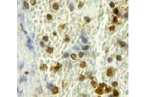 IHC-P analysis of Spleen tissue, with DAB staining.