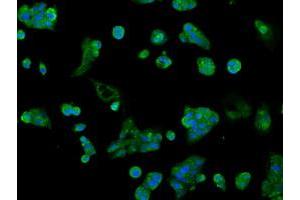 Image no. 2 for anti-Aldo-Keto Reductase Family 1, Member A1 (Aldehyde Reductase) (AKR1A1) antibody (ABIN1496539) (AKR1A1 anticorps)