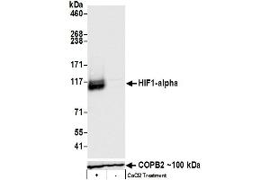 Western Blotting (WB) image for anti-Hypoxia Inducible Factor 1, alpha Subunit (Basic Helix-Loop-Helix Transcription Factor) (HIF1A) (C-Term) antibody (ABIN7455213)