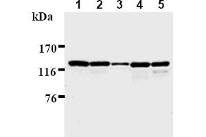 Western Blotting (WB) image for anti-Polymerase (DNA Directed), delta 1, Catalytic Subunit 125kDa (POLD1) antibody (ABIN567776) (POLD1 anticorps)