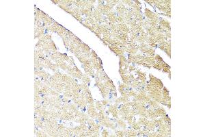 Immunohistochemistry of paraffin-embedded Mouse heart using IFN antibody (ABIN3015562, ABIN3015563, ABIN3015564 and ABIN6218872) at dilution of 1:100 (40x lens). (IFNAR2 anticorps  (AA 27-243))