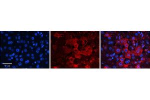 Rabbit Anti-ZNF142 Antibody  Catalog Number: ARP38554_P050 Formalin Fixed Paraffin Embedded Tissue: Human Adult Liver  Observed Staining: Cytoplasm, Membrane in hepatocytes, strong signal, low tissue distribution Primary Antibody Concentration: 1:100 Secondary Antibody: Donkey anti-Rabbit-Cy3 Secondary Antibody Concentration: 1:200 Magnification: 20X Exposure Time: 0. (ZNF142 anticorps  (C-Term))