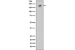 Western blot analysis of EGFR in HeLa cell lysate.