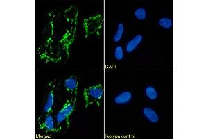Immunofluorescence staining of Kelly cells using anti-CD56.