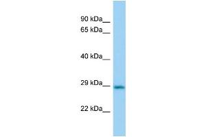 Host:  Rabbit  Target Name:  Cbr2  Sample Type:  Mouse Lung lysates  Antibody Dilution:  1. (CBR2 anticorps  (N-Term))