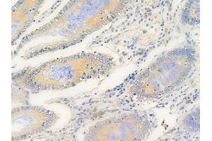 ABIN6264912 and ABIN6269293 at 1/100 staining human normal colon tissue by IHC-P. (RPS6 anticorps  (C-Term))