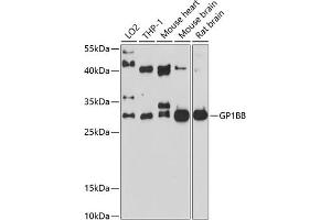 Western blot analysis of extracts of various cell lines, using GP1BB antibody (ABIN6132055, ABIN6141287, ABIN6141288 and ABIN6214244) at 1:1000 dilution. (GP1BB anticorps  (AA 27-147))