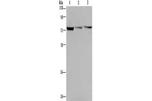 Gel: 8 % SDS-PAGE, Lysate: 40 μg, Lane 1-3: Hela cells, SKOV3 cells, Jurkat cells, Primary antibody: ABIN7130010(KLHL9 Antibody) at dilution 1/300, Secondary antibody: Goat anti rabbit IgG at 1/8000 dilution, Exposure time: 1 minute (KLHL9 anticorps)