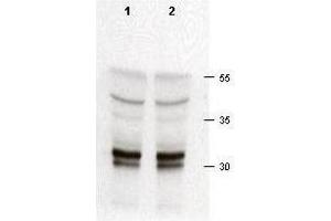 Rabbit anti-cdk2 was used at a 1:200 dilution to detect cdk-2 in asynchronous HeLa cell lysates (run in duplicate). (CDK2 anticorps  (C-Term))