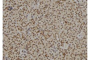 ABIN6264703 and ABIN6269101 at 1/100 staining Rat kidney tissue by IHC-P. (Retinoblastoma Protein (Rb) anticorps  (C-Term))