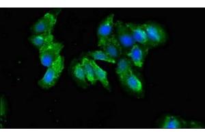 Immunofluorescent analysis of Hela cells using ABIN7148332 at dilution of 1:100 and Alexa Fluor 488-congugated AffiniPure Goat Anti-Rabbit IgG(H+L)
