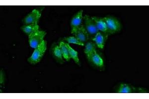 Immunofluorescent analysis of Hela cells using ABIN7148332 at dilution of 1:100 and Alexa Fluor 488-congugated AffiniPure Goat Anti-Rabbit IgG(H+L) (C1QA anticorps  (AA 26-125))