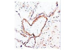 Immunohistochemical analysis of paraffin embedded human placenta sections; staining in cytoplysm; DAB chromogenic reaction (PLGF anticorps  (N-Term))