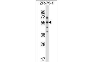 Western blot analysis in ZR-75-1 cell line lysates (35ug/lane). (SGK3 anticorps  (C-Term))