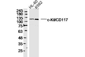 Lane 1: HL-60 lysates Lane 2: K562 lysates probed with c-Kit/CD117 Polyclonal Antibody, Unconjugated  at 1:300 dilution and 4˚C overnight incubation. (KIT anticorps  (AA 451-550))