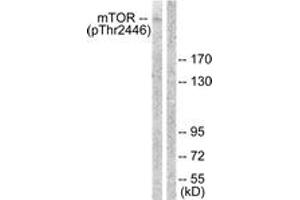 Western blot analysis of extracts from NIH-3T3 cells treated with Insulin 0. (MTOR anticorps  (pThr2446))