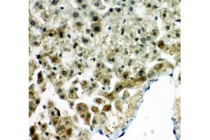 Anti-Peroxiredoxin 5 antibody, IHC(P) IHC(P): Rat Liver Tissue (Peroxiredoxin 5 anticorps  (C-Term))
