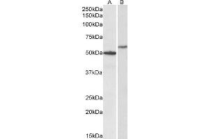 ABIN4902571 (0. (CD47 anticorps)