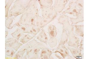 Formalin-fixed and paraffin embedded rat skeletal muscle labeled with Rabbit Anti MYPN Polyclonal Antibody, Unconjugated (ABIN1714212) at 1:200 followed by conjugation to the secondary antibody and DAB staining