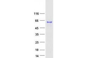 Validation with Western Blot
