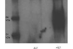 Western Blot and immunoprecipitation of Rabbit anti- IL-7-Receptor-alpha-chain-pY449 antibody. (IL17RA anticorps)