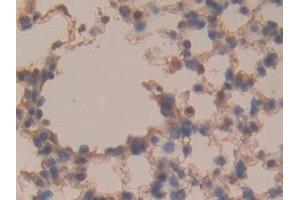 Detection of SOSTDC1 in Mouse Lung Tissue using Polyclonal Antibody to Sclerostin Domain Containing Protein 1 (SOSTDC1)