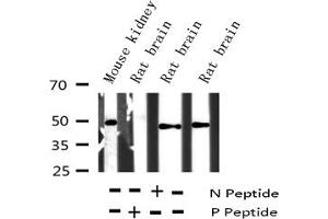 Western blot analysis of Phospho-ATF2 (Thr73 or 55) expression in various lysates