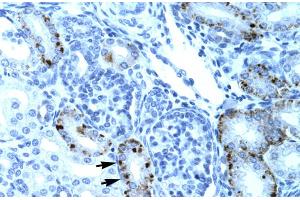Human kidney (TCFL5 anticorps  (Middle Region))