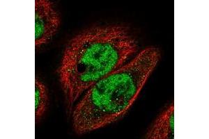 Immunofluorescent staining of human cell line A-431 with IGFALS polyclonal antibody  at 1-4 ug/mL dilution shows positivity in nucleus but not nucleoli. (IGFALS anticorps)