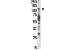 Western Blotting (WB) image for anti-Phosphoinositide-3-Kinase, Catalytic, delta Polypeptide (PIK3CD) antibody (ABIN3003631) (PIK3CD anticorps)
