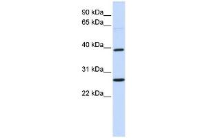 WB Suggested Anti-WNT16 Antibody Titration:  0.