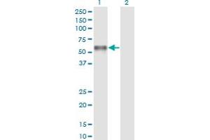 Western Blot analysis of PROC expression in transfected 293T cell line by PROC monoclonal antibody (M01), clone 3A10.