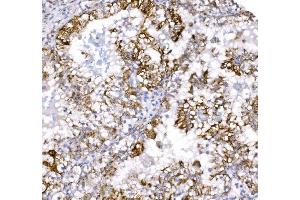 IHC analysis of COX6B1 using anti-COX6B1 antibody (ABIN7603206). (COX6B1 anticorps  (N-Term))